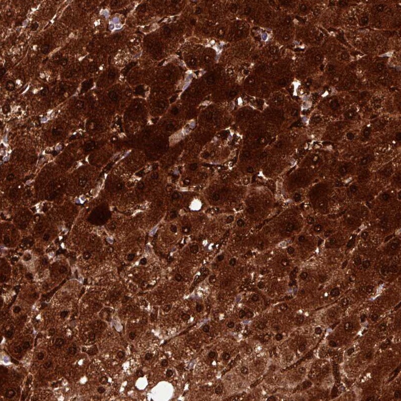 Arginase 1/ARG1/liver Arginase Antibody (CL0186) - Azide and BSA Free Immunohistochemistry-Paraffin: Arginase 1/ARG1/liver Arginase Antibody [NBP3-44441]