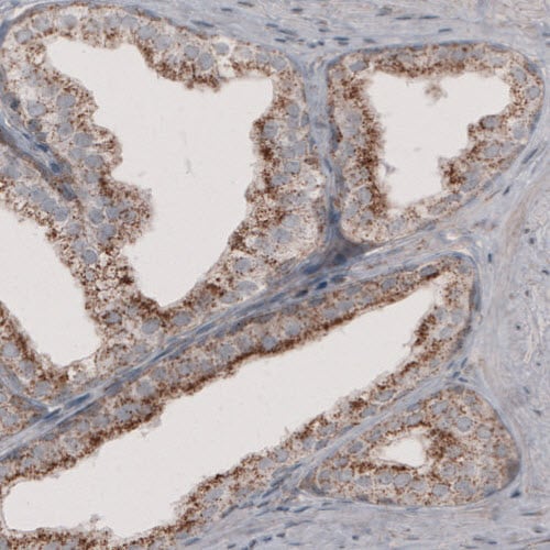 ACAA1 Antibody (CL2660) - Azide and BSA Free Immunohistochemistry-Paraffin: ACAA1 Antibody [NBP3-44447]