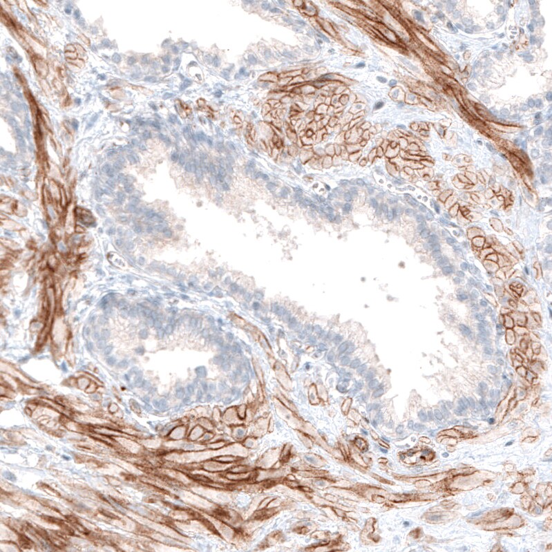 Integrin beta 3/CD61 Antibody (CL7319) - Azide and BSA Free Immunohistochemistry-Paraffin: Integrin beta 3/CD61 Antibody [NBP3-44448]