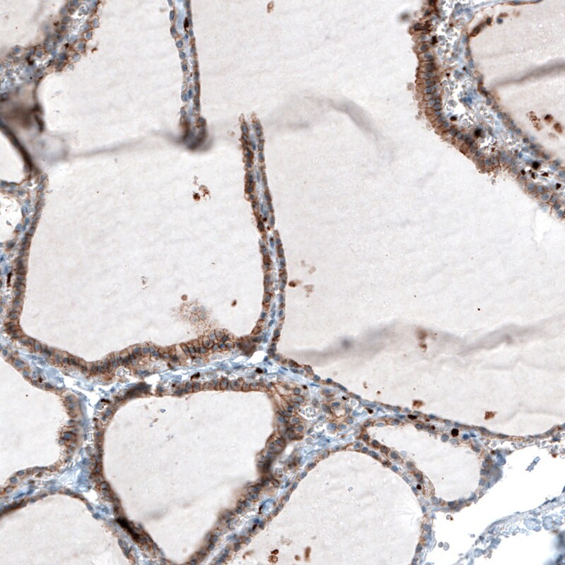 Integrin beta 3/CD61 Antibody (CL7319) - Azide and BSA Free Immunohistochemistry-Paraffin: Integrin beta 3/CD61 Antibody [NBP3-44448]