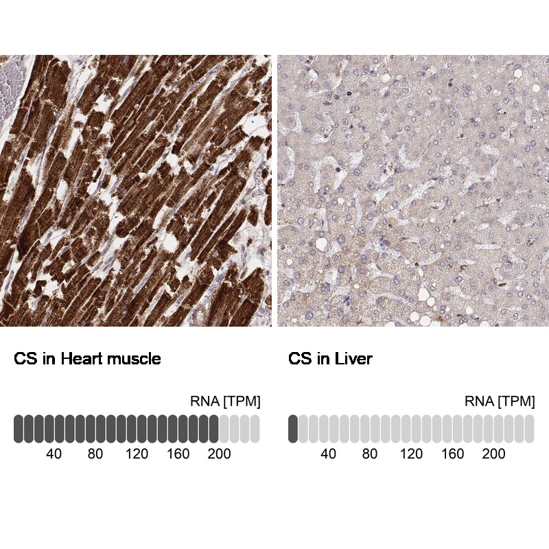 CS Citrate Synthase Antibody (CL2545) - Azide and BSA Free Immunohistochemistry-Paraffin: CS Citrate Synthase Antibody [NBP3-44449]