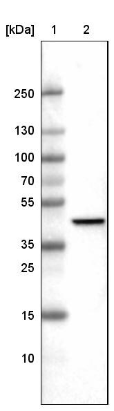 CS Citrate Synthase Antibody (CL2545) - Azide and BSA Free Western Blot: CS Citrate Synthase Antibody [NBP3-44449]