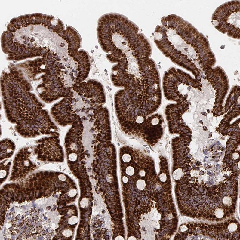 CS Citrate Synthase Antibody (CL2545) - Azide and BSA Free Immunohistochemistry-Paraffin: CS Citrate Synthase Antibody [NBP3-44449]