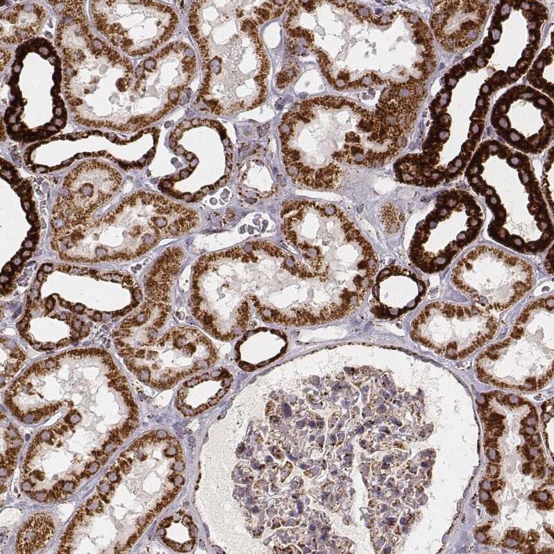 CS Citrate Synthase Antibody (CL2545) - Azide and BSA Free Immunohistochemistry-Paraffin: CS Citrate Synthase Antibody [NBP3-44449]