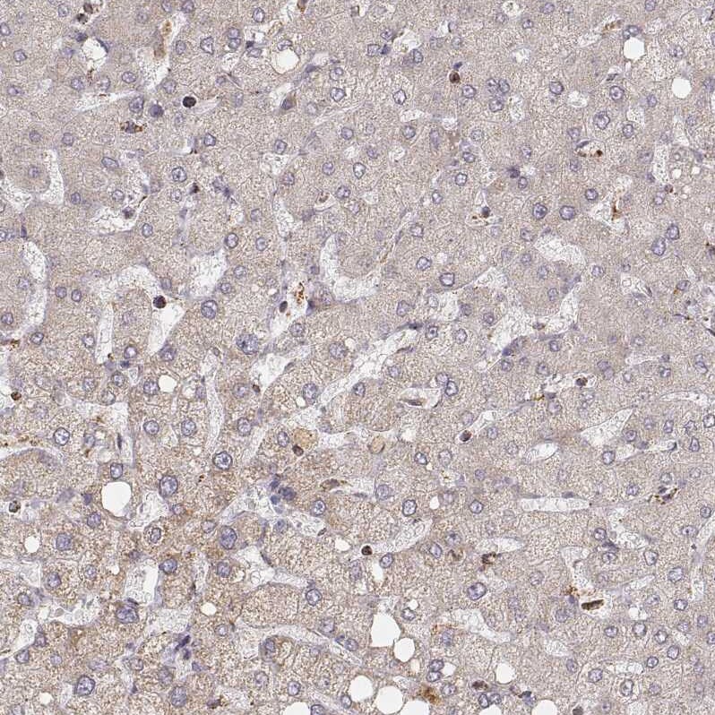 CS Citrate Synthase Antibody (CL2545) - Azide and BSA Free Immunohistochemistry-Paraffin: CS Citrate Synthase Antibody [NBP3-44449]