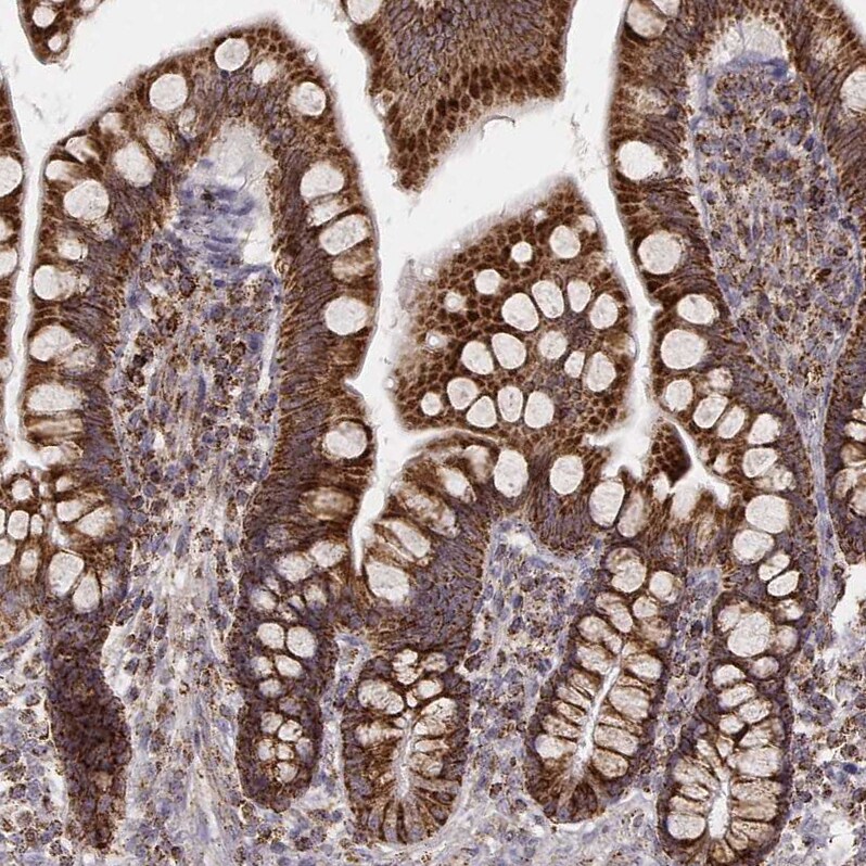 CS Citrate Synthase Antibody (CL2548) - Azide and BSA Free Immunohistochemistry-Paraffin: CS Citrate Synthase Antibody [NBP3-44450]