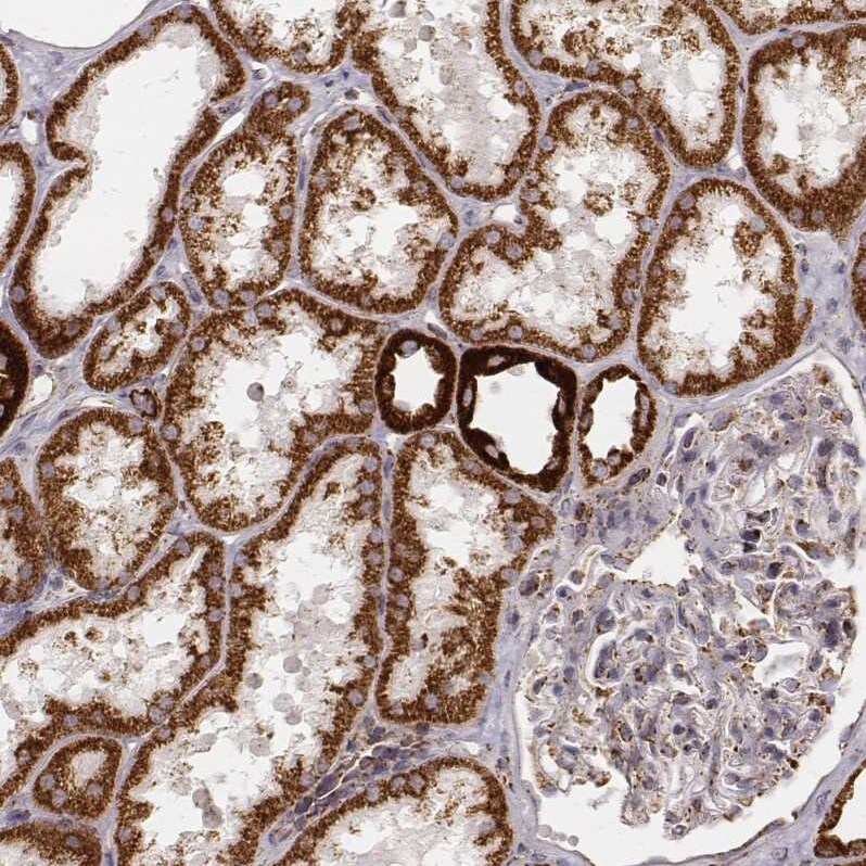 CS Citrate Synthase Antibody (CL2553) - Azide and BSA Free Immunohistochemistry-Paraffin: CS Citrate Synthase Antibody [NBP3-44451]