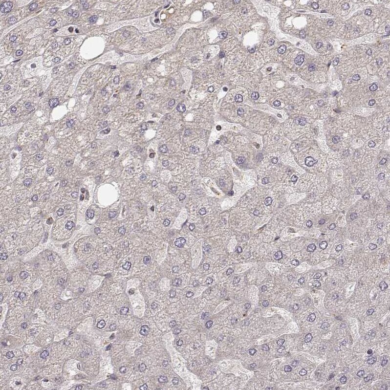 CS Citrate Synthase Antibody (CL2553) - Azide and BSA Free Immunohistochemistry-Paraffin: CS Citrate Synthase Antibody [NBP3-44451]