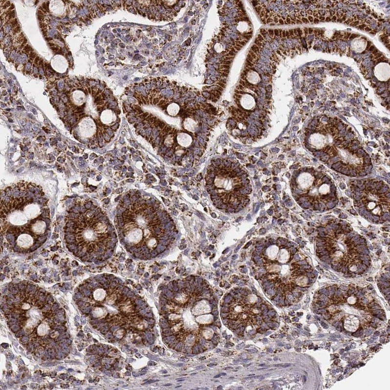 CS Citrate Synthase Antibody (CL2553) - Azide and BSA Free Immunohistochemistry-Paraffin: CS Citrate Synthase Antibody [NBP3-44451]