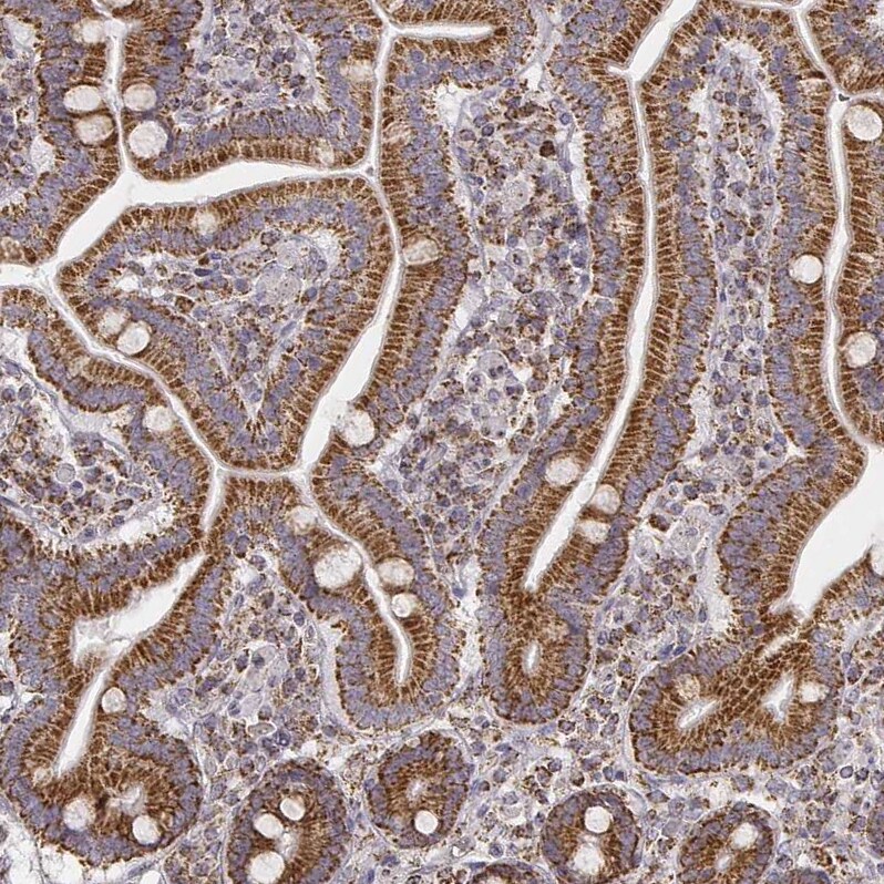 CS Citrate Synthase Antibody (CL2561) - Azide and BSA Free Immunohistochemistry-Paraffin: CS Citrate Synthase Antibody [NBP3-44452]