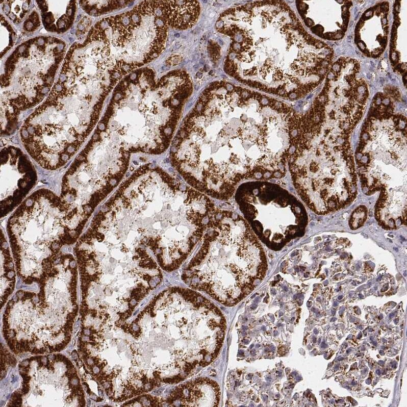 CS Citrate Synthase Antibody (CL2579) - Azide and BSA Free Immunohistochemistry-Paraffin: CS Citrate Synthase Antibody [NBP3-44453]