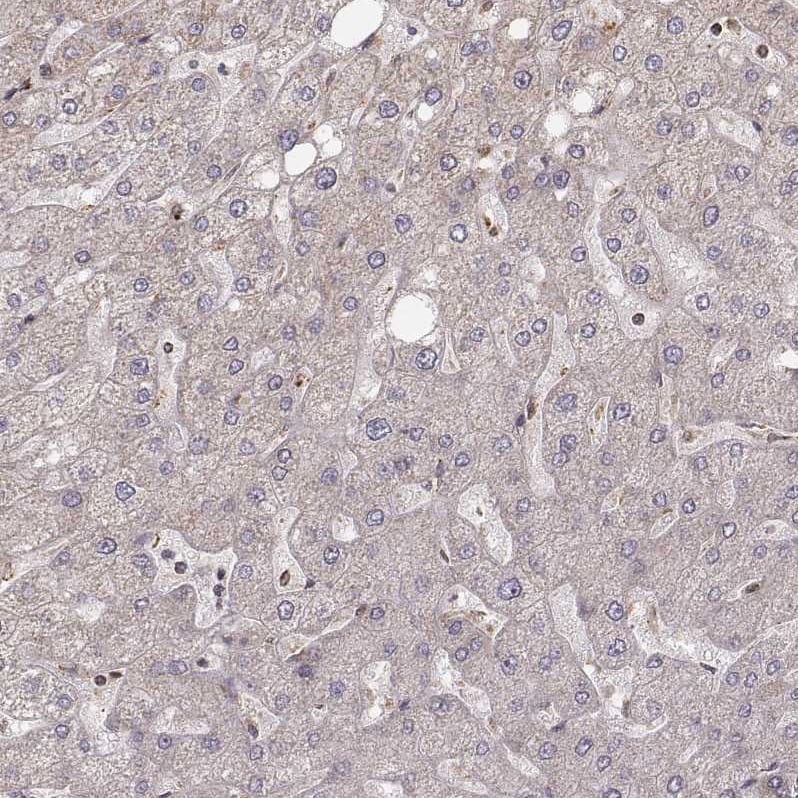 CS Citrate Synthase Antibody (CL2579) - Azide and BSA Free Immunohistochemistry-Paraffin: CS Citrate Synthase Antibody [NBP3-44453]