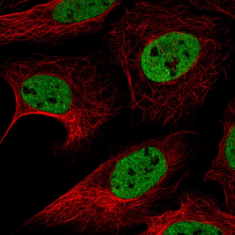hnRNP C1 + C2 Antibody (CL2596) - Azide and BSA Free Immunocytochemistry/ Immunofluorescence: hnRNP C1 + C2 Antibody [NBP3-44454]