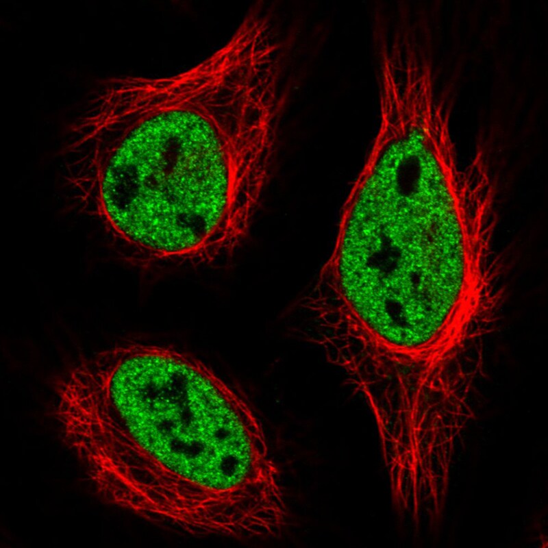 hnRNP C1 + C2 Antibody (CL2596) - Azide and BSA Free Immunocytochemistry/ Immunofluorescence: hnRNP C1 + C2 Antibody [NBP3-44454]
