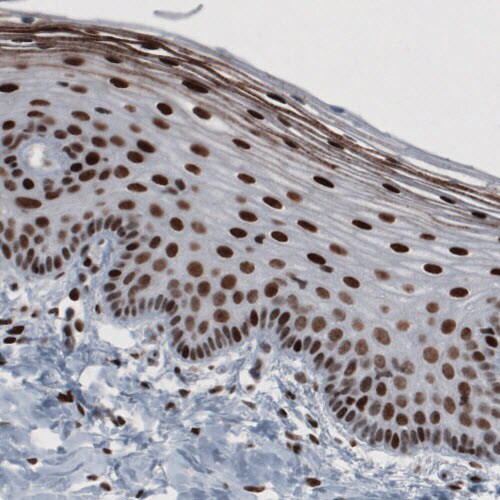 hnRNP C1 + C2 Antibody (CL2596) - Azide and BSA Free Immunohistochemistry-Paraffin: hnRNP C1 + C2 Antibody [NBP3-44454]