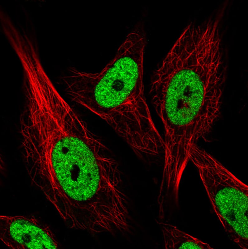 hnRNP C1 + C2 Antibody (CL2596) - Azide and BSA Free Immunocytochemistry/ Immunofluorescence: hnRNP C1 + C2 Antibody [NBP3-44454]
