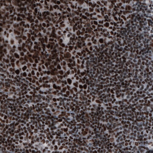 hnRNP C1 + C2 Antibody (CL2596) - Azide and BSA Free Immunohistochemistry-Paraffin: hnRNP C1 + C2 Antibody [NBP3-44454]