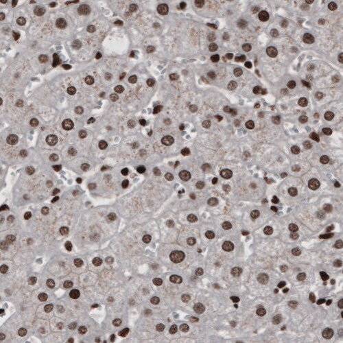 hnRNP C1 + C2 Antibody (CL2596) - Azide and BSA Free Immunohistochemistry-Paraffin: hnRNP C1 + C2 Antibody [NBP3-44454]