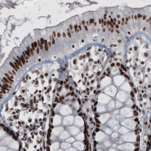 hnRNP C1 + C2 Antibody (CL2596) - Azide and BSA Free Immunohistochemistry-Paraffin: hnRNP C1 + C2 Antibody [NBP3-44454]