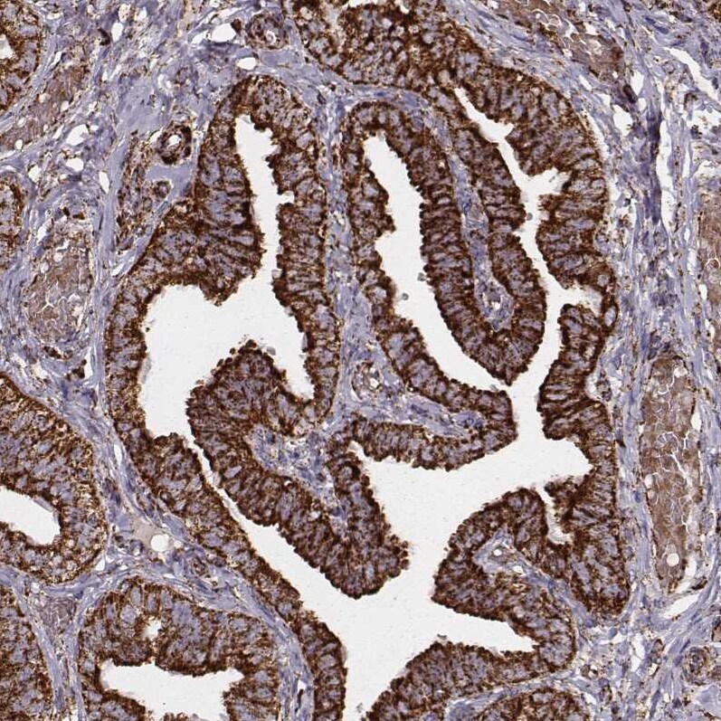 TUFM Antibody (CL2243) - Azide and BSA Free Immunohistochemistry-Paraffin: TUFM Antibody [NBP3-44456]
