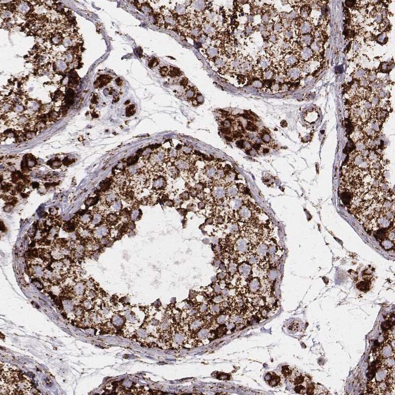 TUFM Antibody (CL2243) - Azide and BSA Free Immunohistochemistry-Paraffin: TUFM Antibody [NBP3-44456]