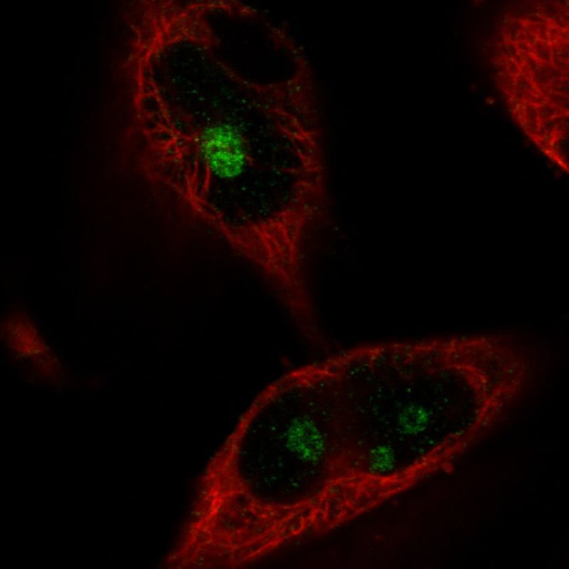 NIFK Antibody (CL2240) - Azide and BSA Free Immunocytochemistry/ Immunofluorescence: NIFK Antibody [NBP3-44459]