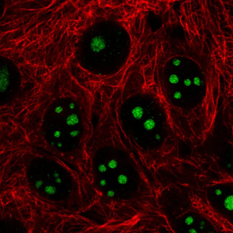 NIFK Antibody (CL2240) - Azide and BSA Free Immunocytochemistry/ Immunofluorescence: NIFK Antibody [NBP3-44459]