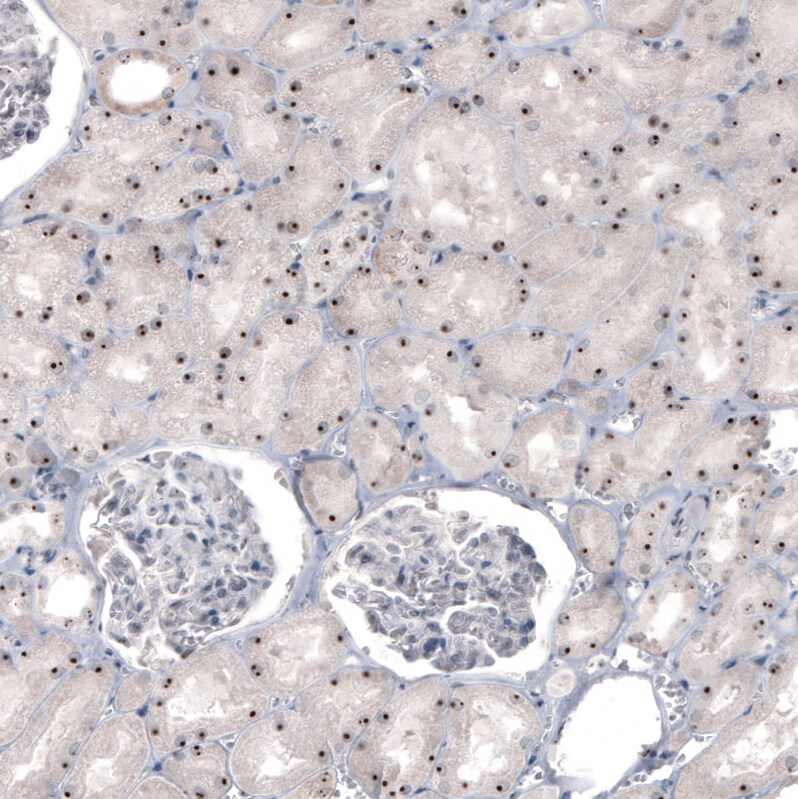 NIFK Antibody (CL2240) - Azide and BSA Free Immunohistochemistry-Paraffin: NIFK Antibody [NBP3-44459]