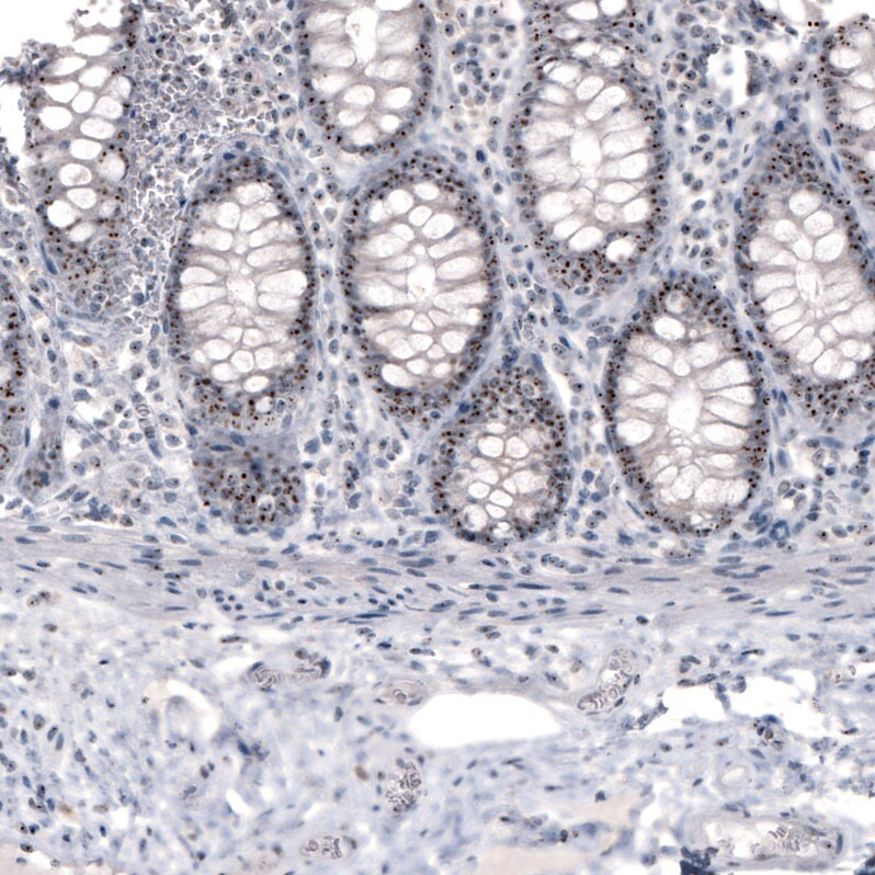 NIFK Antibody (CL2240) - Azide and BSA Free Immunohistochemistry-Paraffin: NIFK Antibody [NBP3-44459]