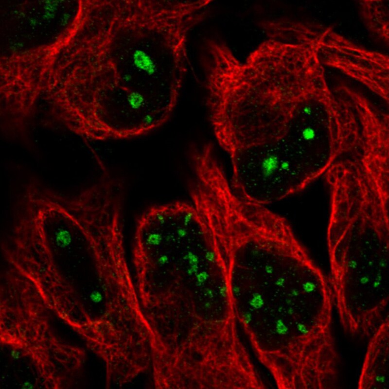 NIFK Antibody (CL2240) - Azide and BSA Free Immunocytochemistry/ Immunofluorescence: NIFK Antibody [NBP3-44459]