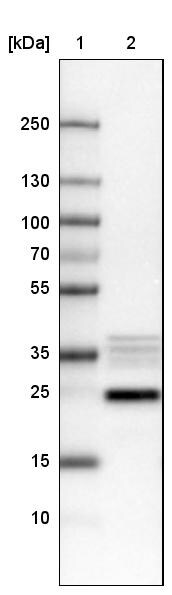NIFK Antibody (CL2237) - Azide and BSA Free Western Blot: NIFK Antibody [NBP3-44460]