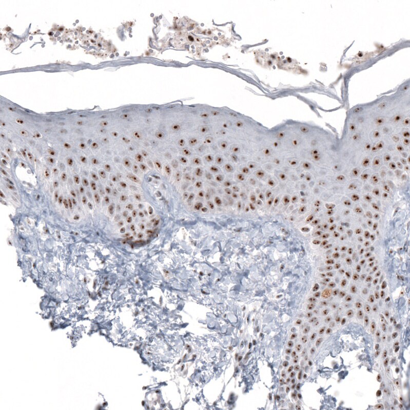 NIFK Antibody (CL2237) - Azide and BSA Free Immunohistochemistry-Paraffin: NIFK Antibody [NBP3-44460]