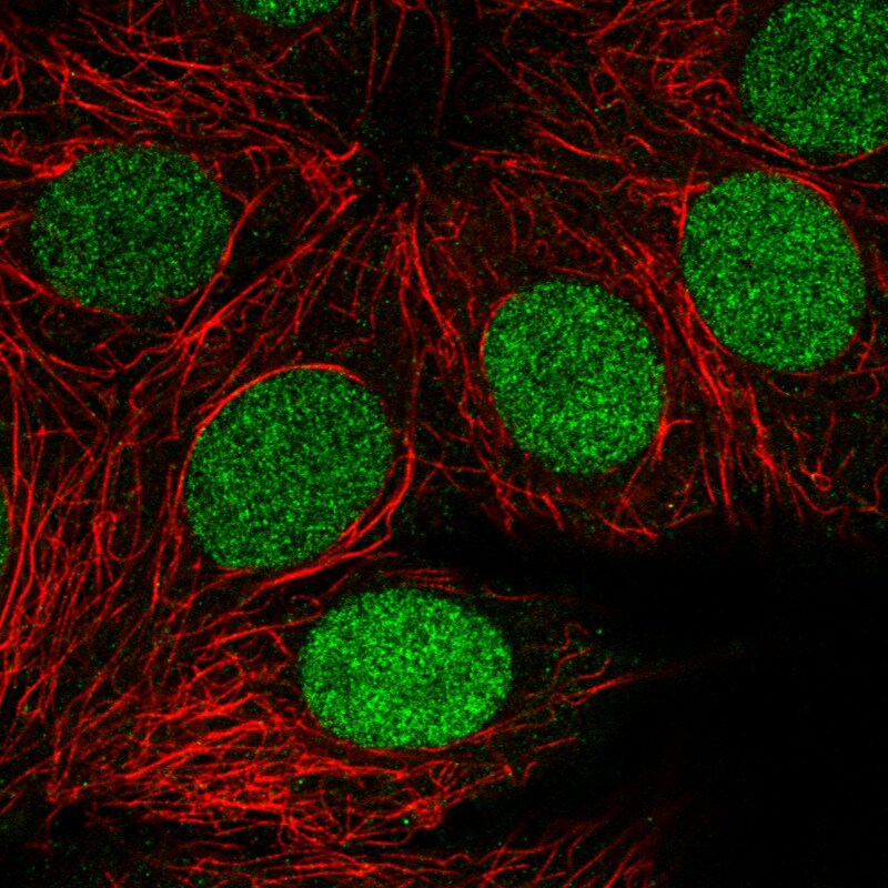 PARP Antibody (CL2220) - Azide and BSA Free Immunocytochemistry/ Immunofluorescence: PARP Antibody [NBP3-44461]