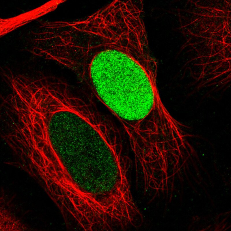 PARP Antibody (CL2220) - Azide and BSA Free Immunocytochemistry/ Immunofluorescence: PARP Antibody [NBP3-44461]