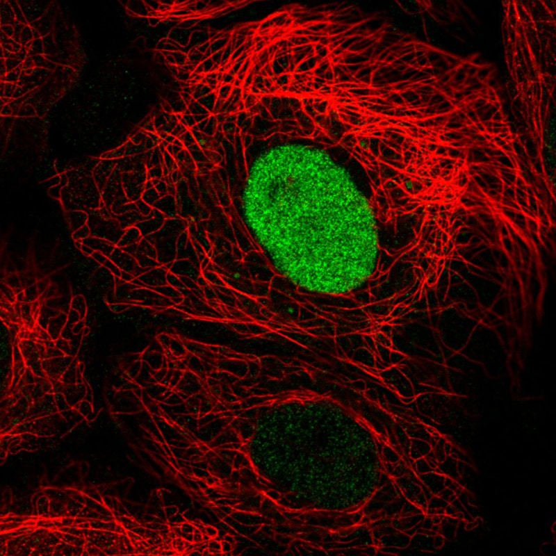 PARP Antibody (CL2220) - Azide and BSA Free Immunocytochemistry/ Immunofluorescence: PARP Antibody [NBP3-44461]