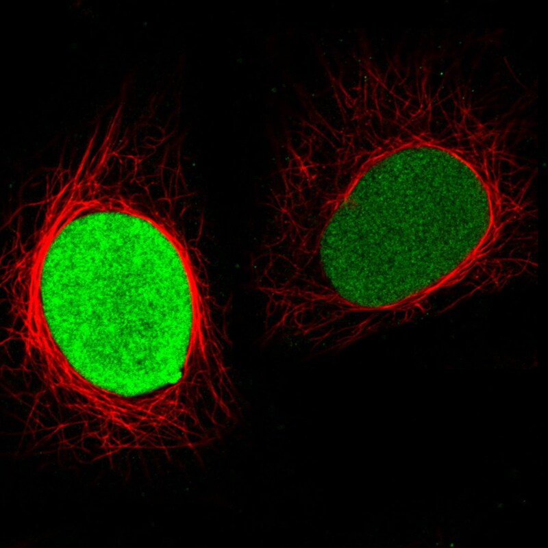 PARP Antibody (CL2220) - Azide and BSA Free Immunocytochemistry/ Immunofluorescence: PARP Antibody [NBP3-44461]