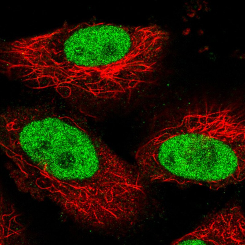 PARP Antibody (CL2220) - Azide and BSA Free Immunocytochemistry/ Immunofluorescence: PARP Antibody [NBP3-44461]