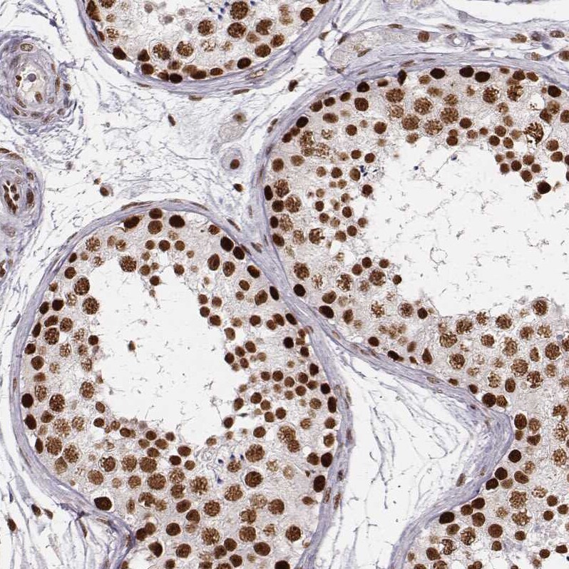 PARP Antibody (CL2220) - Azide and BSA Free Immunohistochemistry-Paraffin: PARP Antibody [NBP3-44461]
