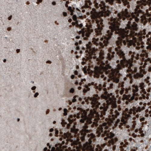 PARP Antibody (CL2209) - Azide and BSA Free Immunohistochemistry-Paraffin: PARP Antibody [NBP3-44462]