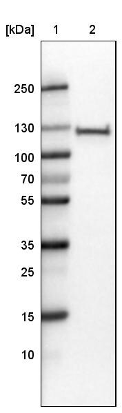 PARP Antibody (CL2209) - Azide and BSA Free Western Blot: PARP Antibody [NBP3-44462]