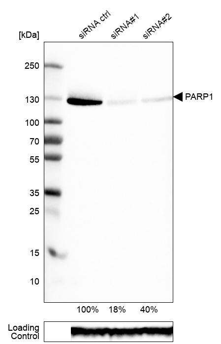 PARP Antibody (CL2209) - Azide and BSA Free Western Blot: PARP Antibody [NBP3-44462]