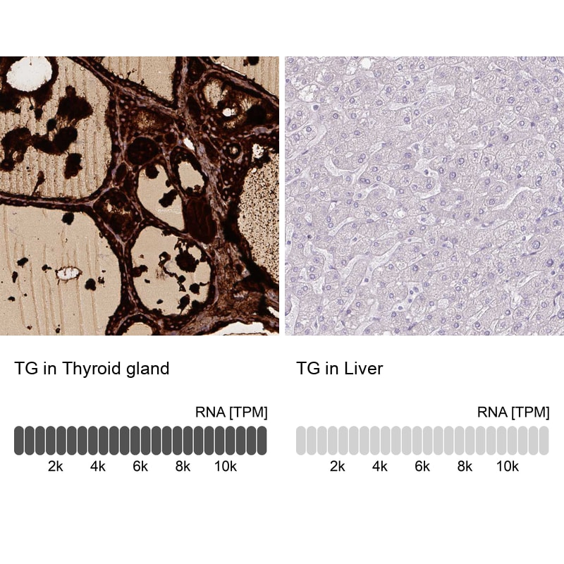 Thyroglobulin Antibody (CL0164) - Azide and BSA Free Immunohistochemistry-Paraffin: Thyroglobulin Antibody [NBP3-44463]