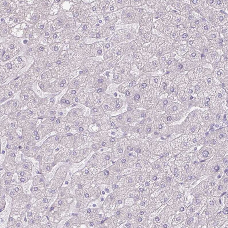Thyroglobulin Antibody (CL0164) - Azide and BSA Free Immunohistochemistry-Paraffin: Thyroglobulin Antibody [NBP3-44463]