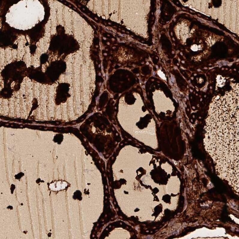 Thyroglobulin Antibody (CL0164) - Azide and BSA Free Immunohistochemistry-Paraffin: Thyroglobulin Antibody [NBP3-44463]