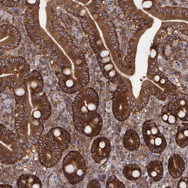 VPS26A Antibody (CL2287) - Azide and BSA Free Immunohistochemistry-Paraffin: VPS26A Antibody [NBP3-44464]