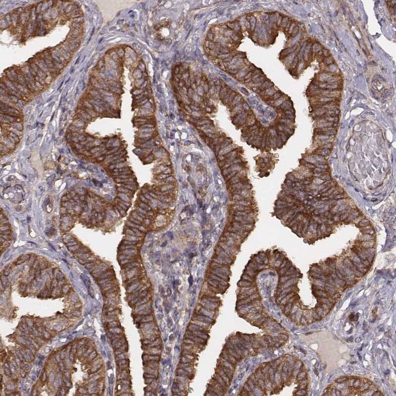 VPS26A Antibody (CL2287) - Azide and BSA Free Immunohistochemistry-Paraffin: VPS26A Antibody [NBP3-44464]