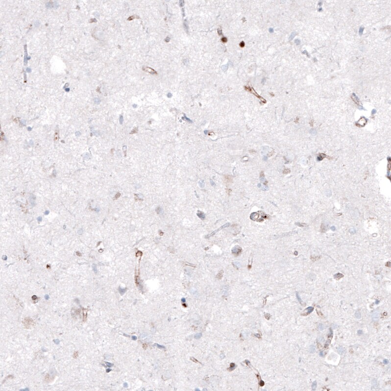 Zyxin Antibody (CL2502) - Azide and BSA Free Immunohistochemistry-Paraffin: Zyxin Antibody [NBP3-44466]