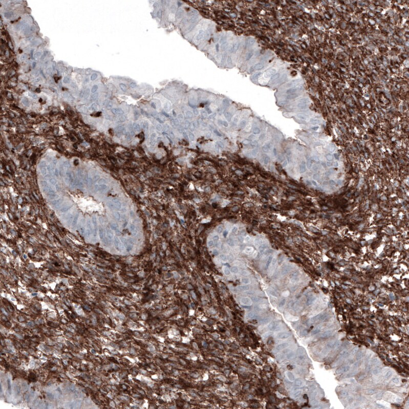 Zyxin Antibody (CL2502) - Azide and BSA Free Immunohistochemistry-Paraffin: Zyxin Antibody [NBP3-44466]