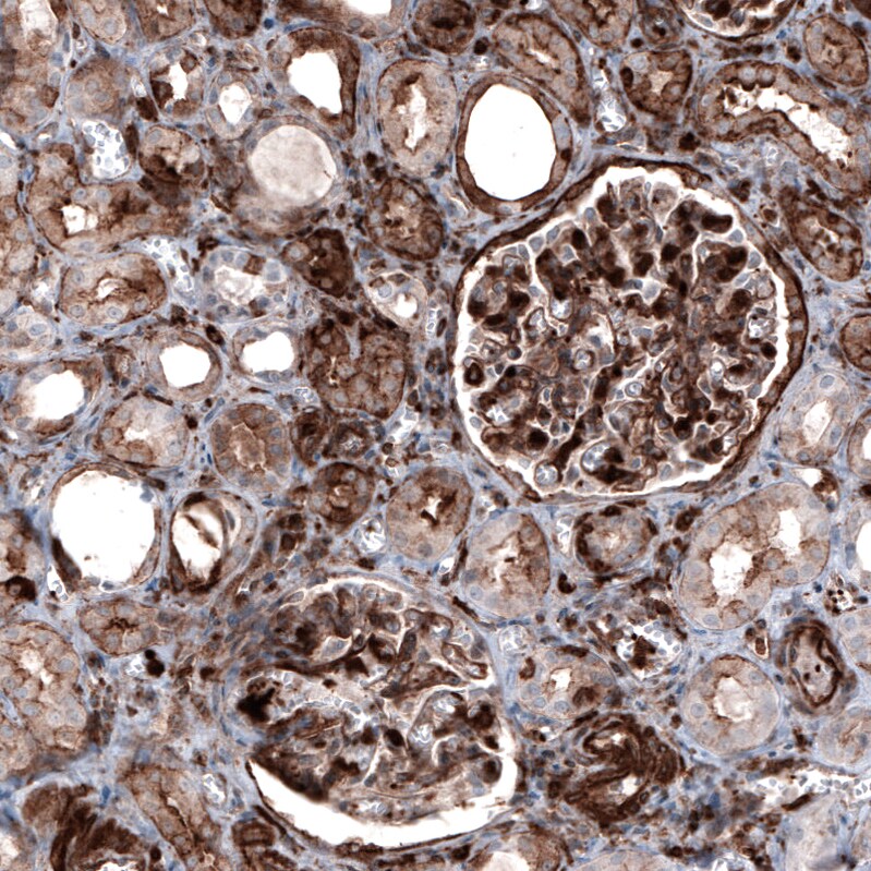 Zyxin Antibody (CL2502) - Azide and BSA Free Immunohistochemistry-Paraffin: Zyxin Antibody [NBP3-44466]