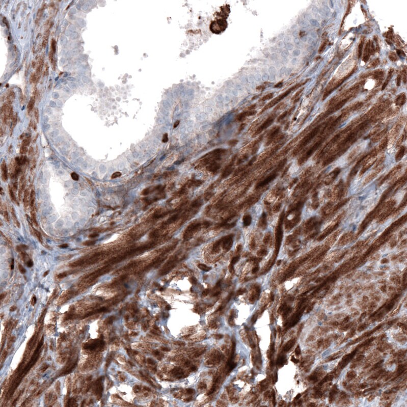 Zyxin Antibody (CL2502) - Azide and BSA Free Immunohistochemistry-Paraffin: Zyxin Antibody [NBP3-44466]